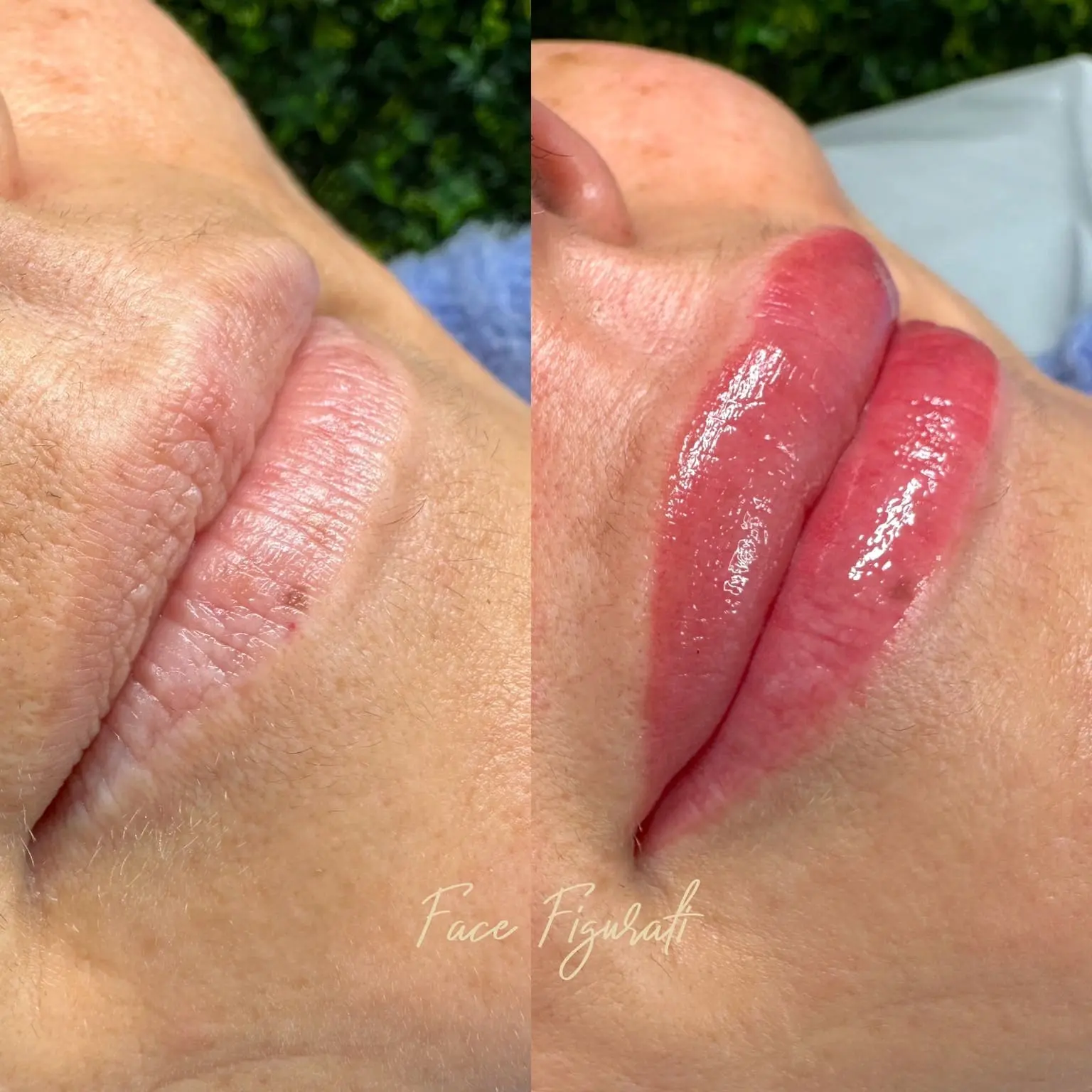 cosmetic lip tattoo melbourne
