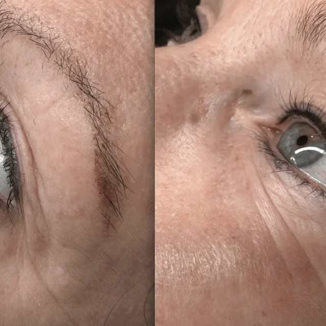 cosmetic tattoo eyeliner