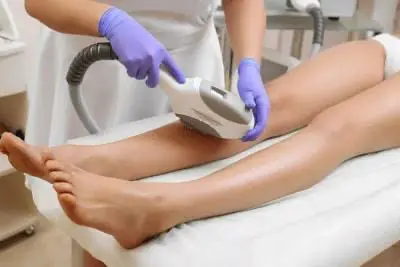 laser hair removal