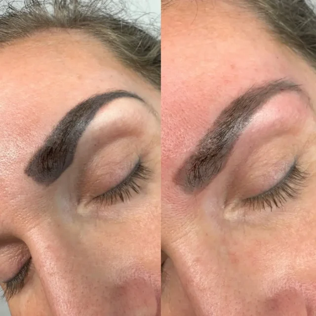 permanent makeup removal near me