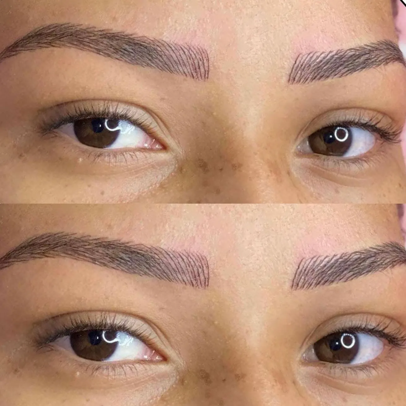 Anti-Wrinkle Effects on Brows