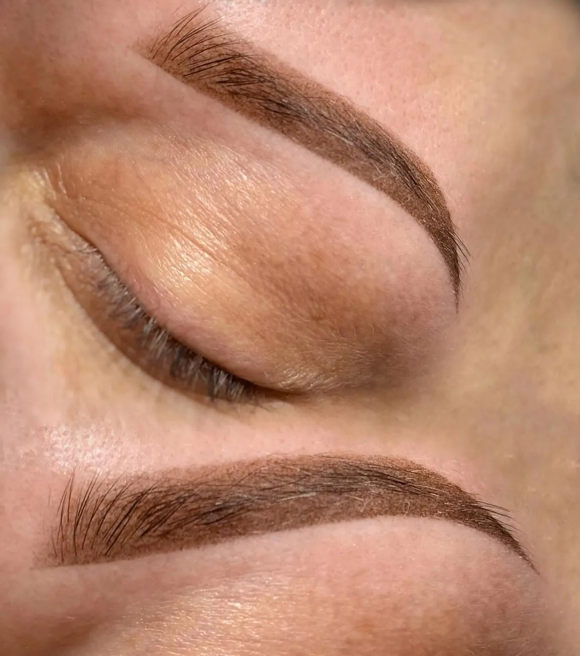 Causes Of Eyebrow Hair Loss
