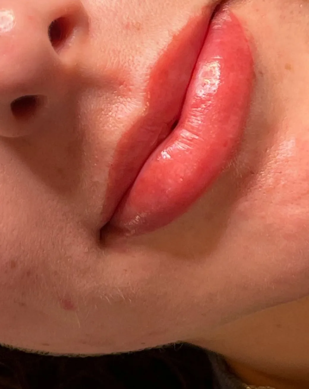 The Role Of Skin Type And Health