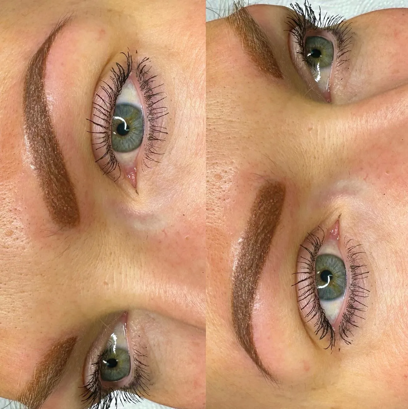What Is The Best Eyebrow Procedure For No Eyebrows