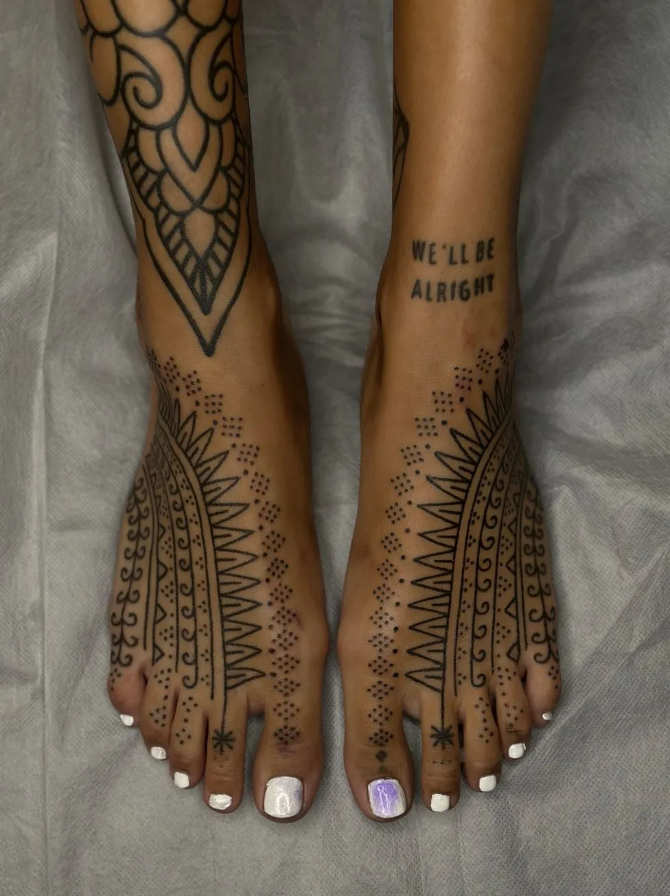 What Skin Is Prone To Tattoo Blowout