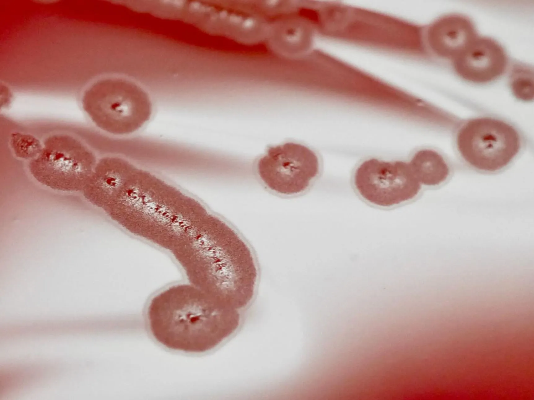 What To Do If You Suspect Infection