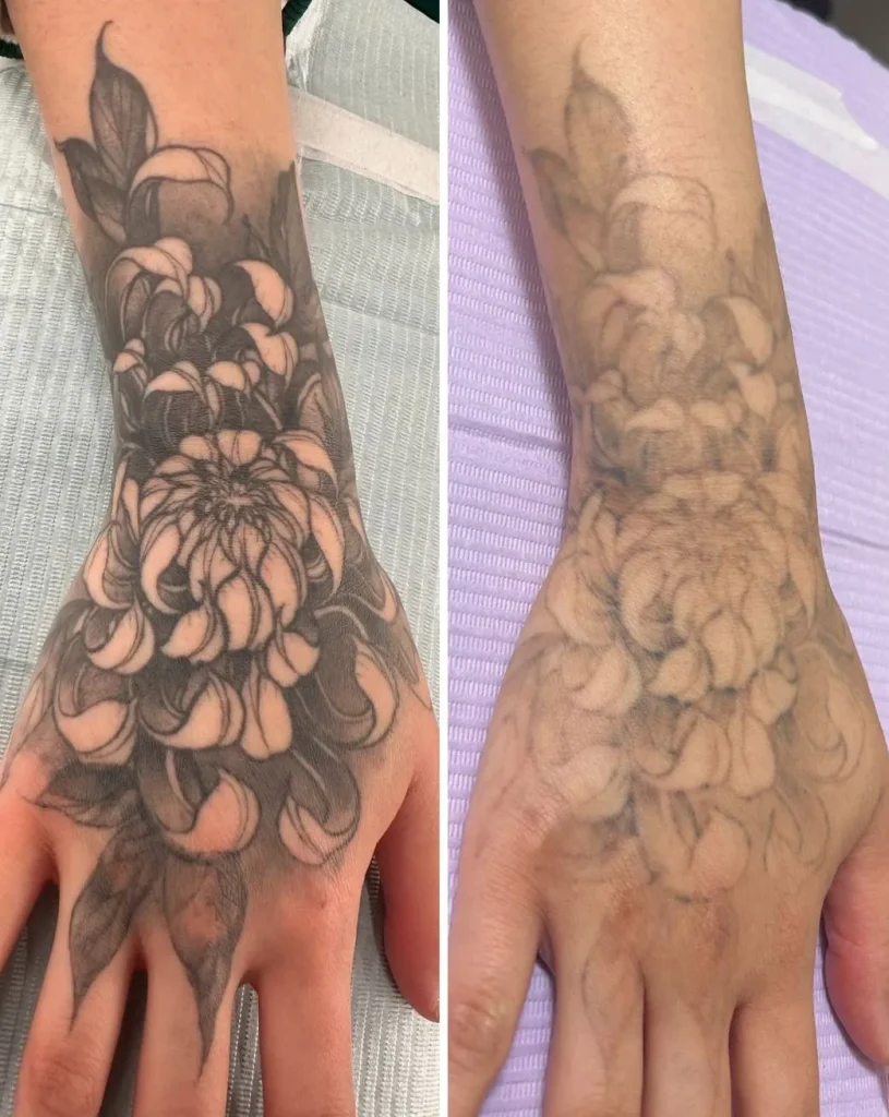 What To Do If You’re Not Happy With A Tattoo