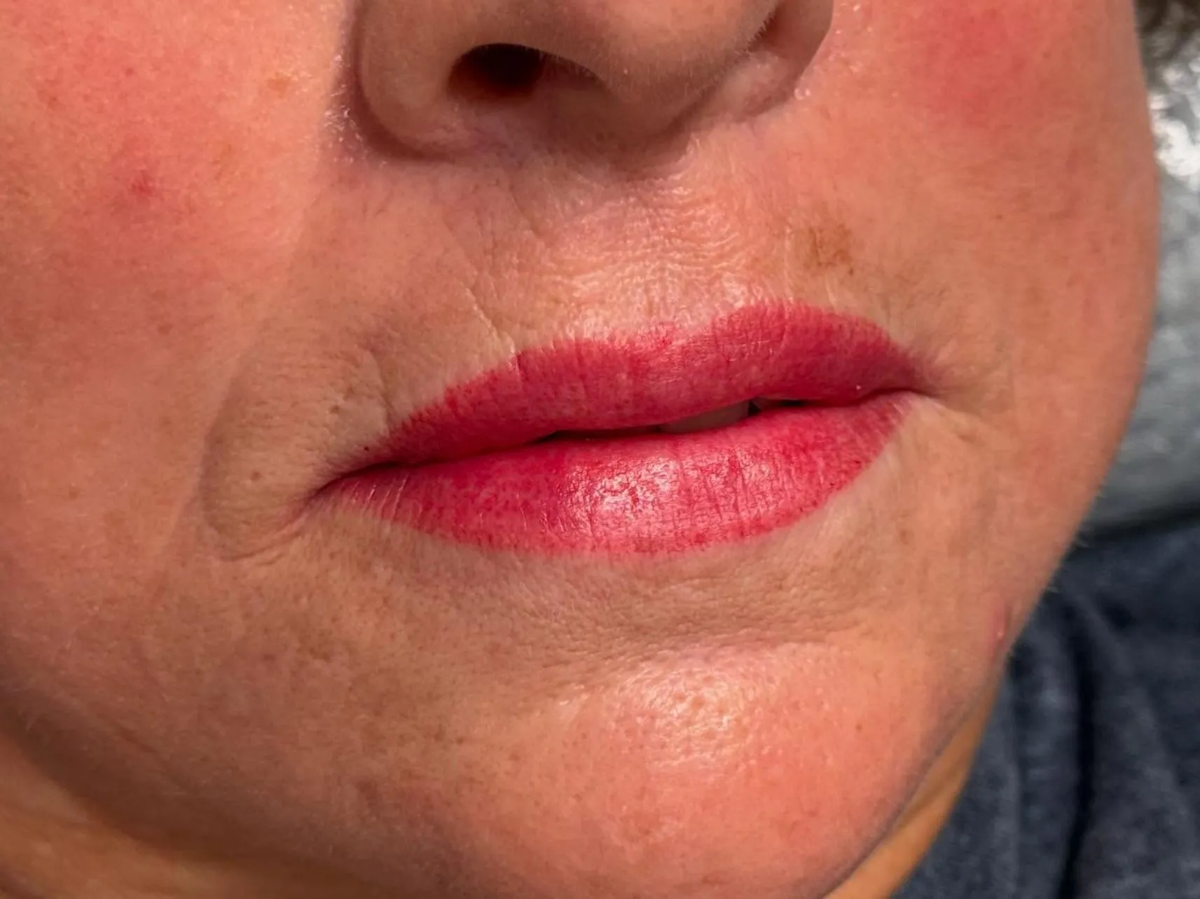 Why Lip Pigment Breaks Down Faster
