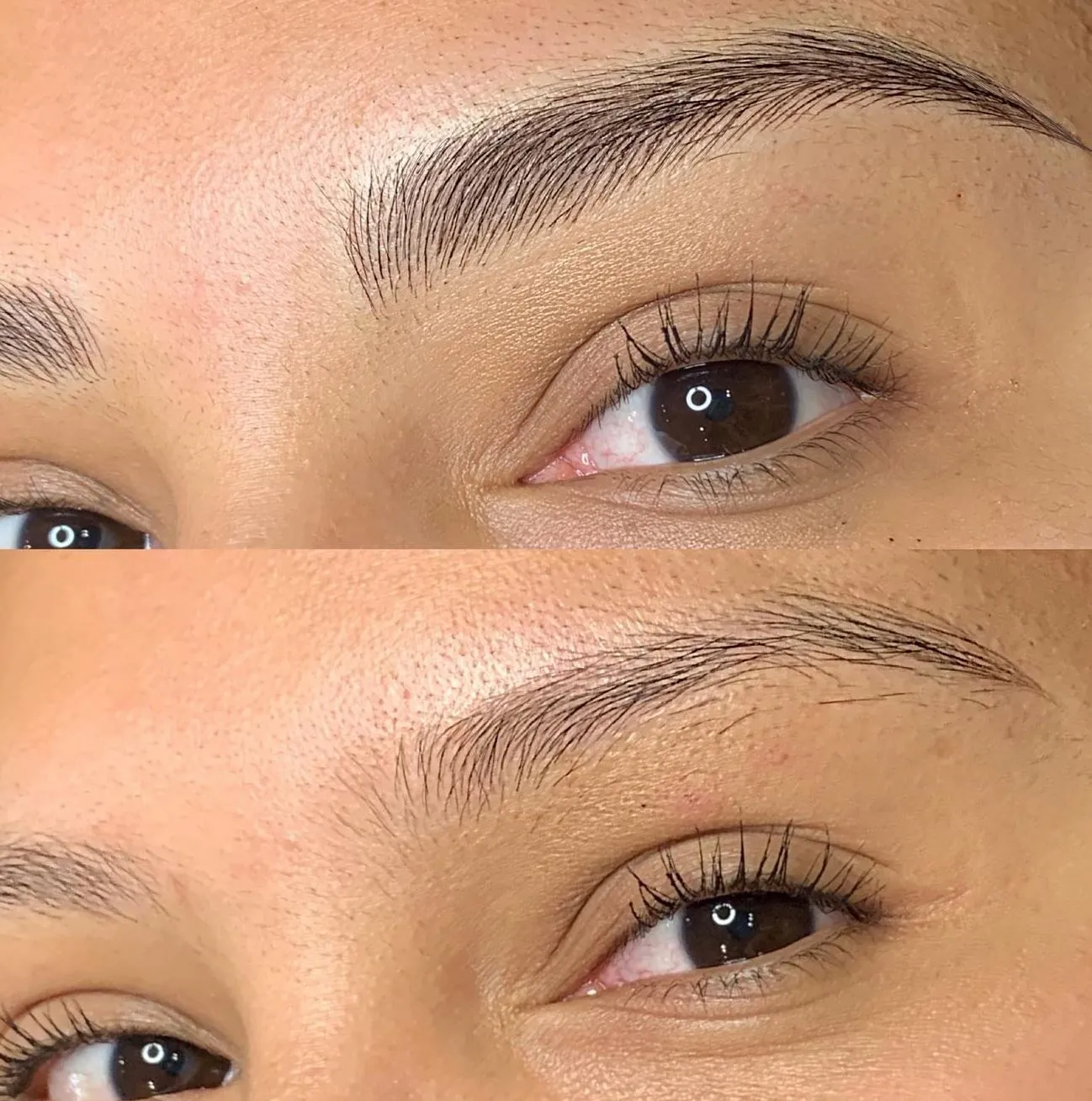 Why Procedure Timing Impacts Brow Results
