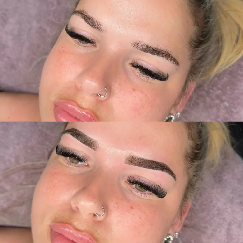 Why Sun Damage Is Worse In Brisbane