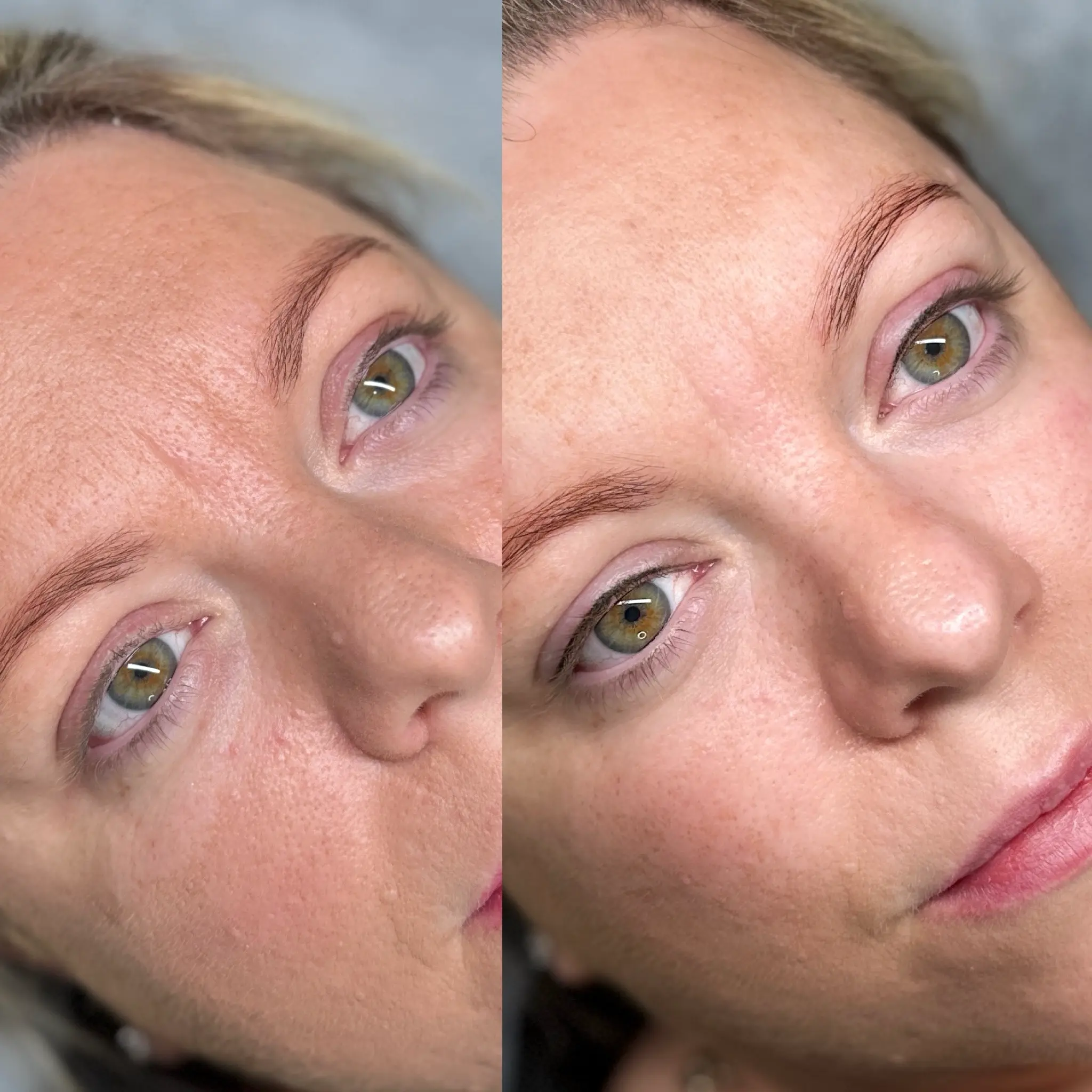 lash line enhancement before and after