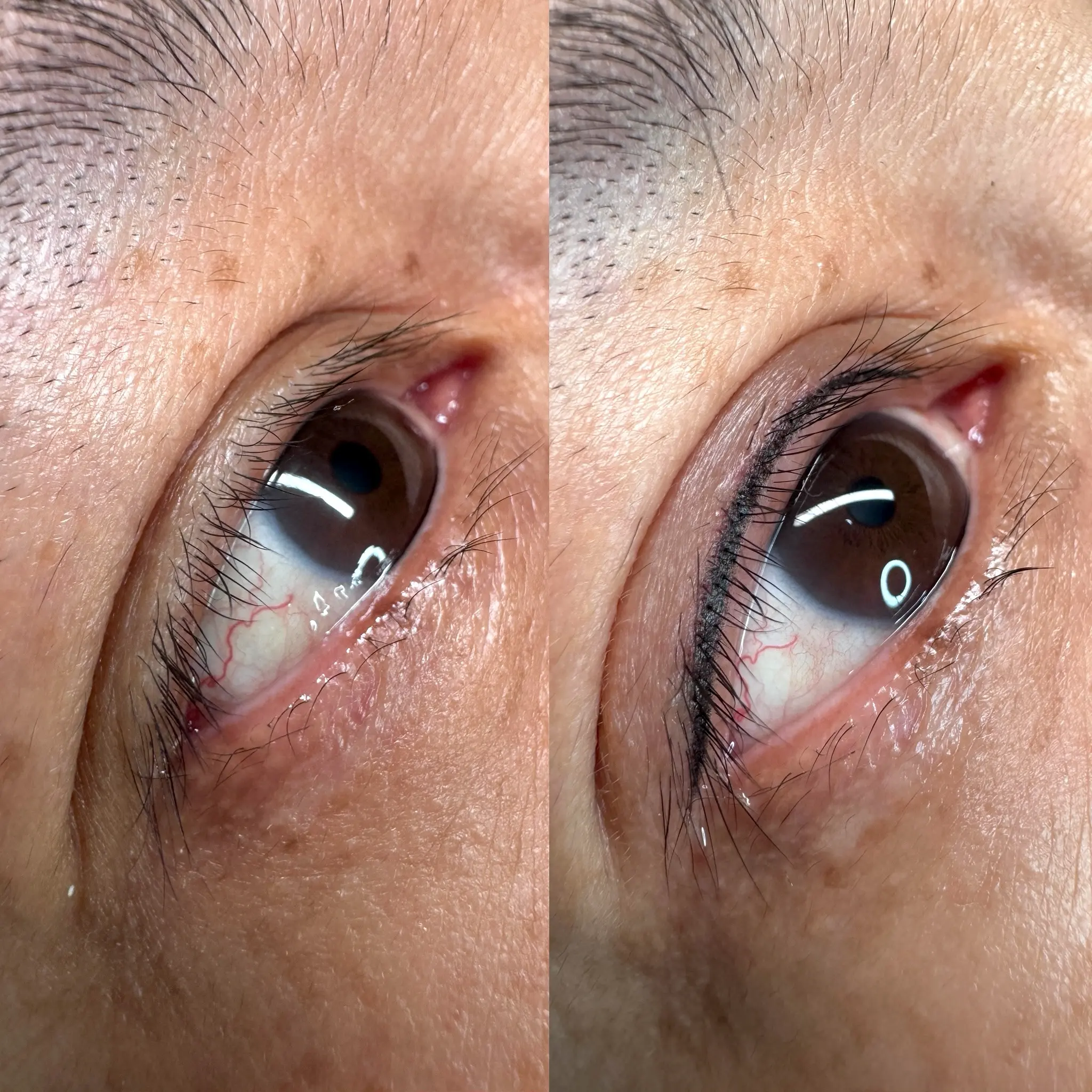 lash line enhancement