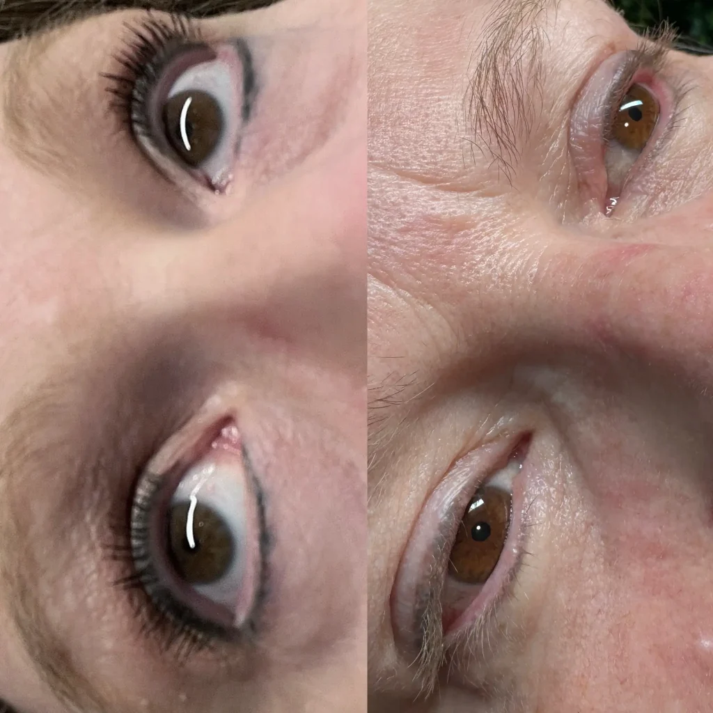 permanent makeup tattoo removal