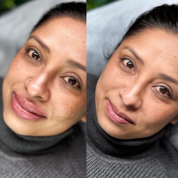 Brisbane cosmetic lip tattooing