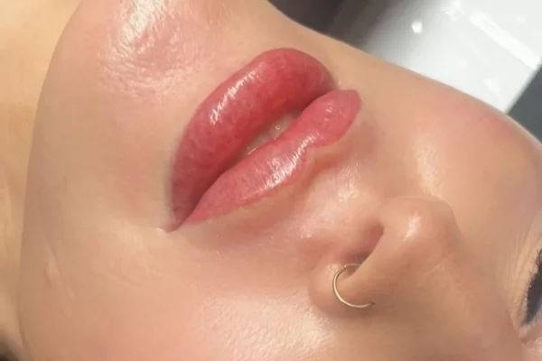 Lip Tattoo vs Lip Fillers