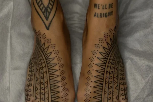 What Skin Is Prone To Tattoo Blowout