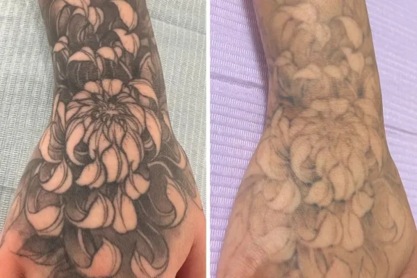 What To Do If You’re Not Happy With A Tattoo