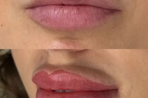 Why is Sun bad for tattoos