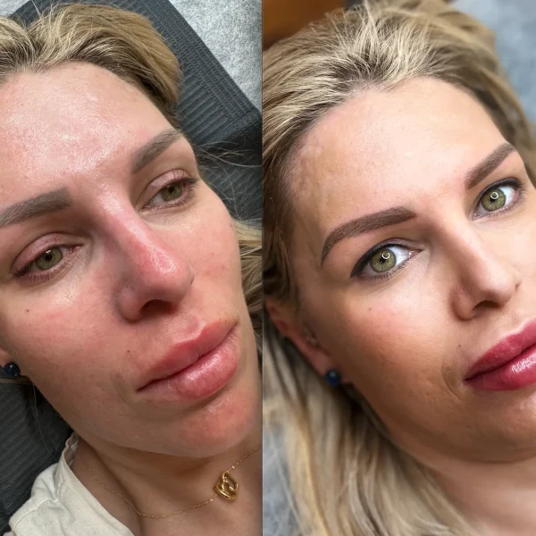 blonde microblading before and after