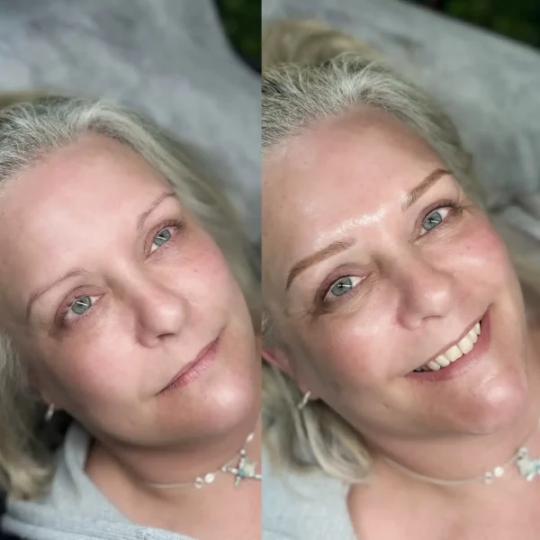 melbourne combination brows