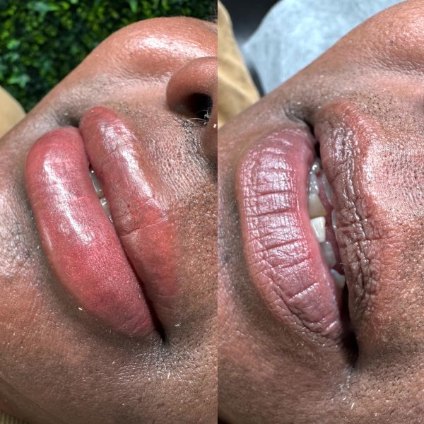 cosmetic lip tattoo best lip tattoo Brisbane