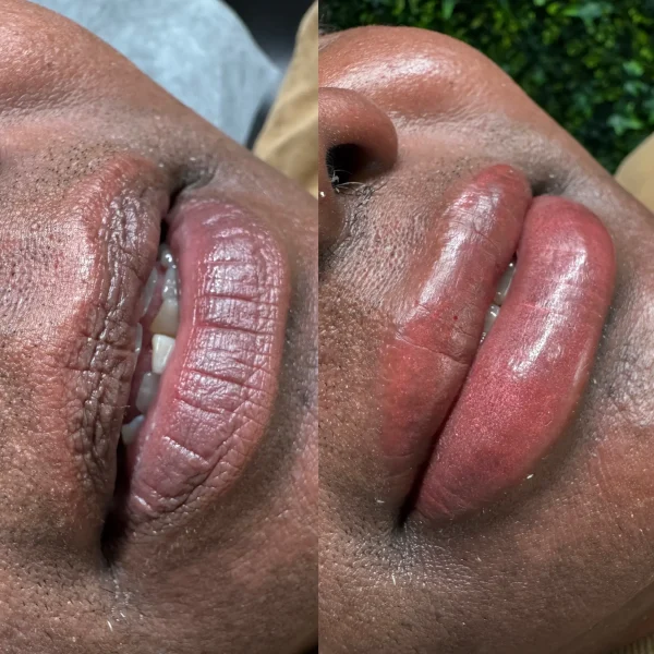 cosmetic lip tattoo melbourne