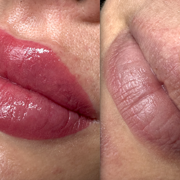 cosmetic lip tattoos Brisbane