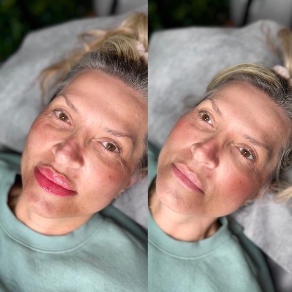 cosmetic tattoo lips Brisbane