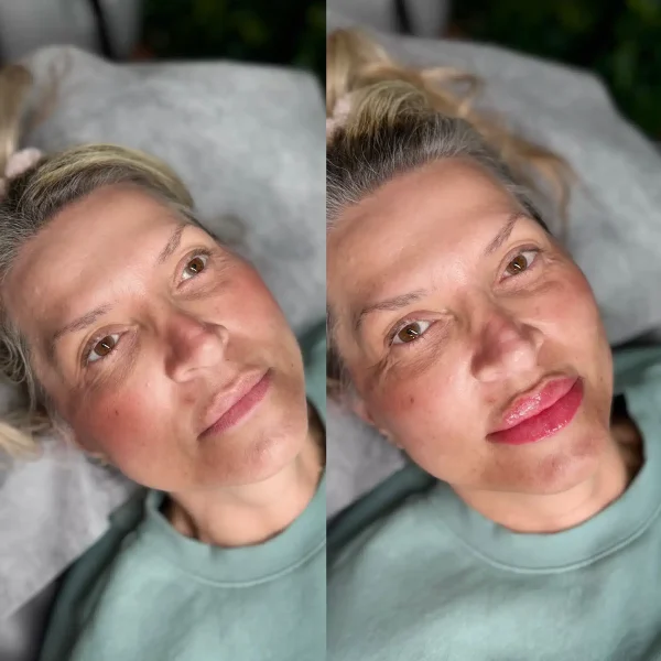 cosmetic tattoo lips