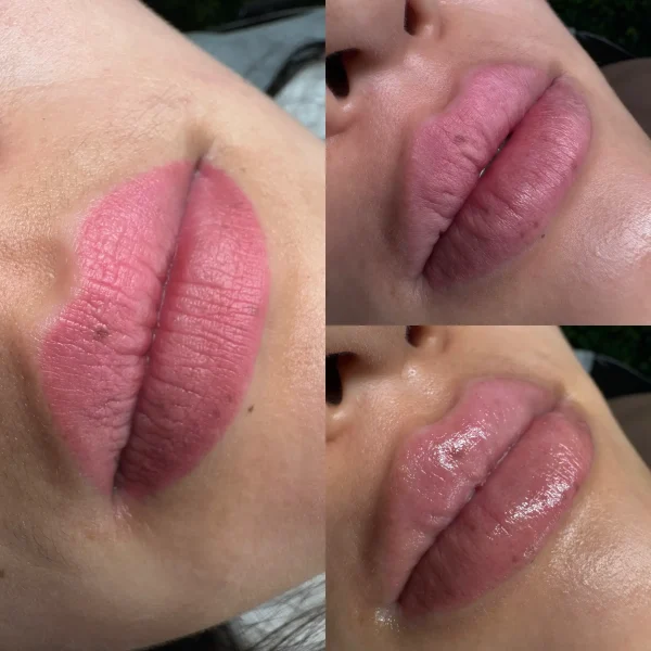 cosmetic tattoo removal near me