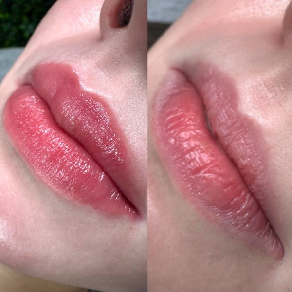 cosmetic tattooing lips Brisbane