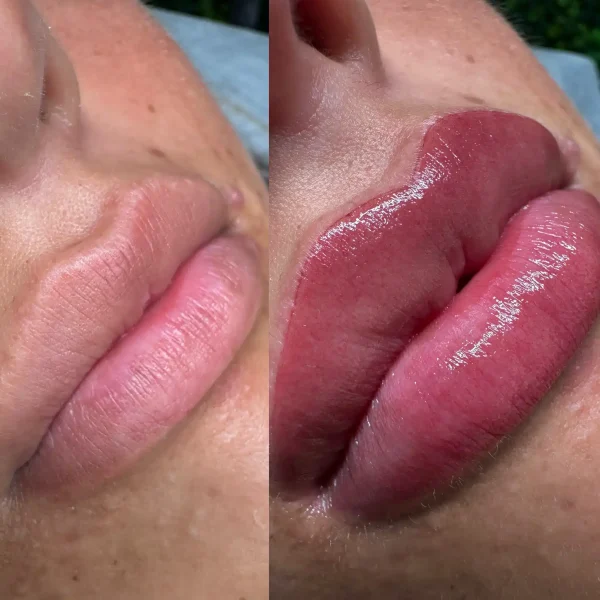 cosmetic tattooing melbourne