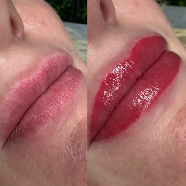 cosmetic tattooing
