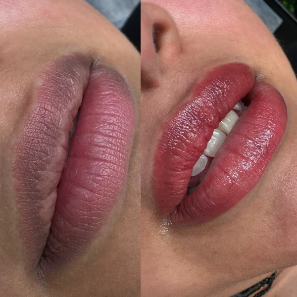 dark lip neutralization near me