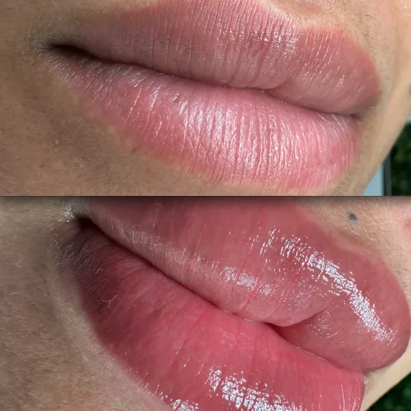 do lip tattoos hurt