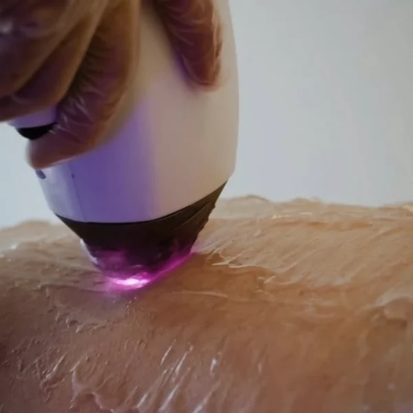 full body hair removal