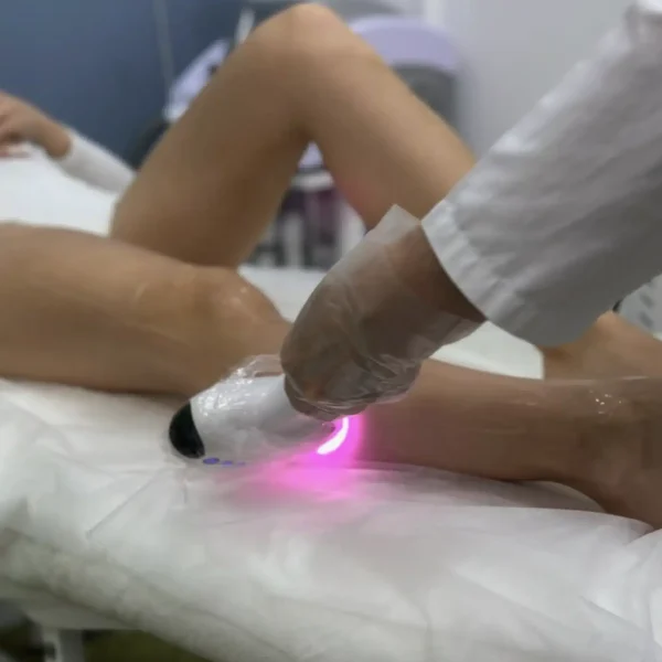full body laser hair removal price
