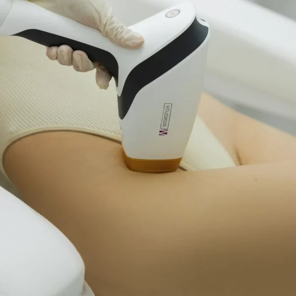 full body laser hair