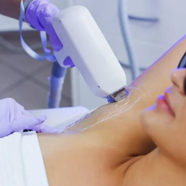 laser full body hair removal