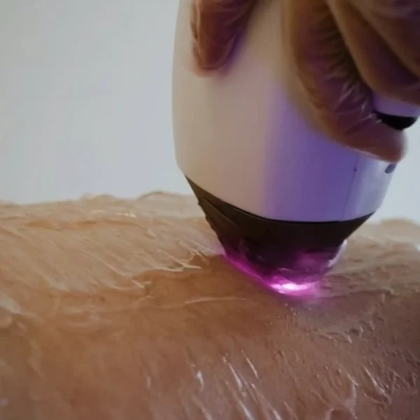 laser full body