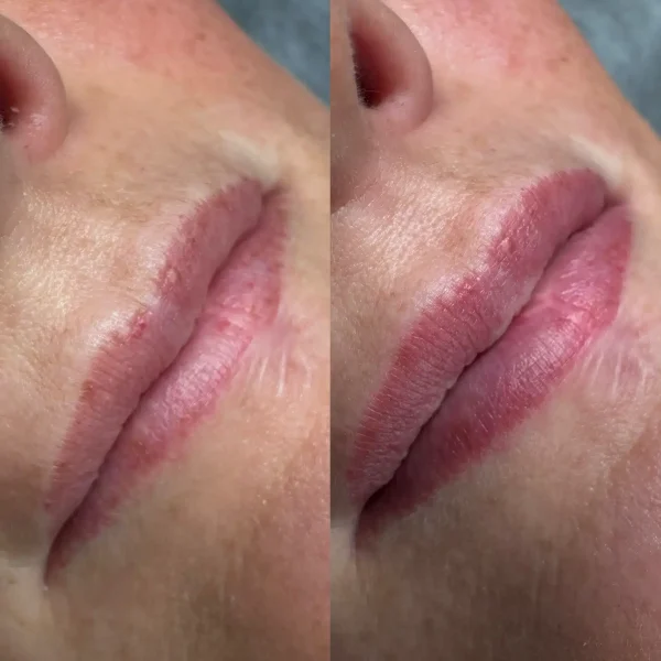 lip blush cost