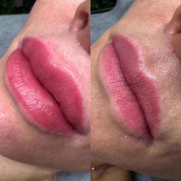 lip blush