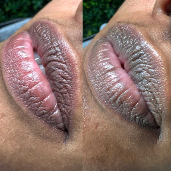 lip blush treatment Brisbane