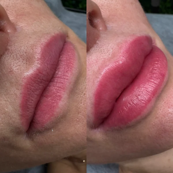 lip blush
