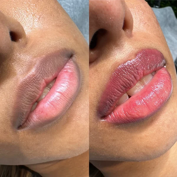 lip blushing on dark lips in melbourne