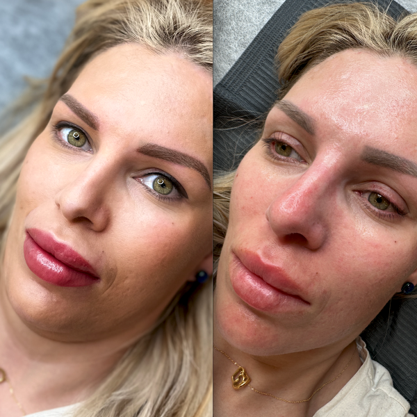 lip cosmetic tattoo in Brisbane