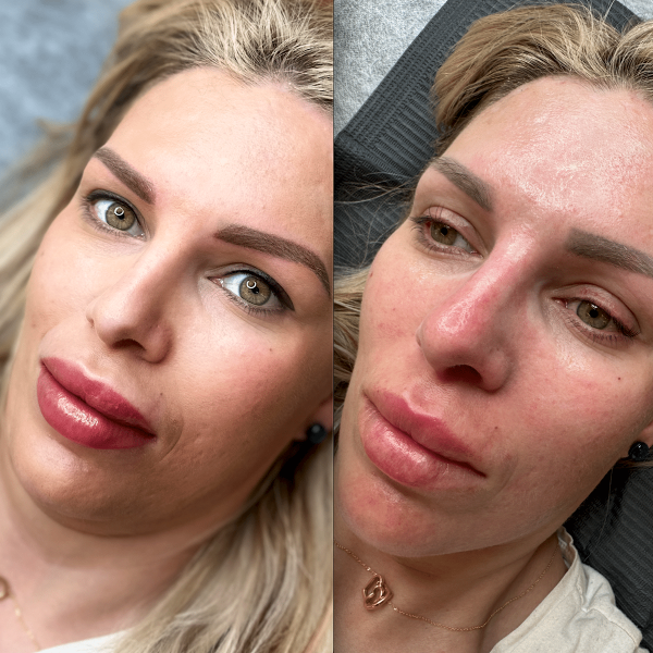 lip cosmetic tattoo in Brisbane