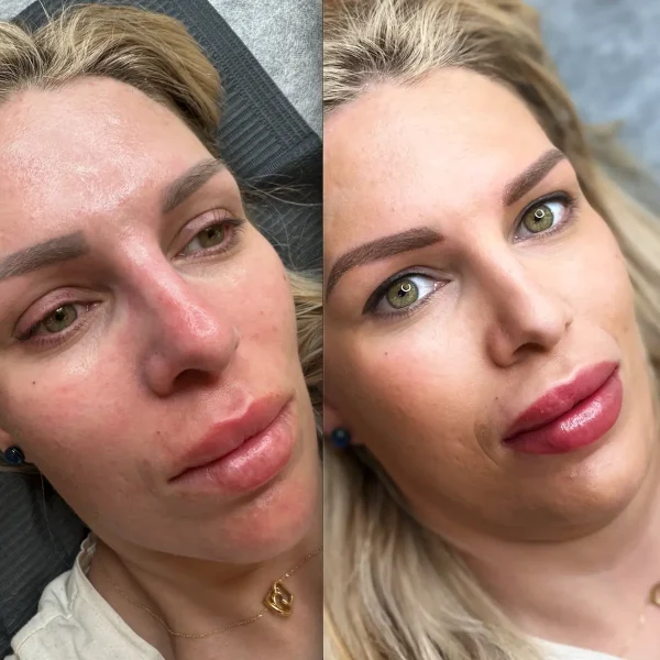 lip cosmetic tattoo