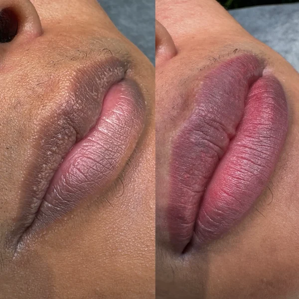 lip neutralization tattoo melbourne