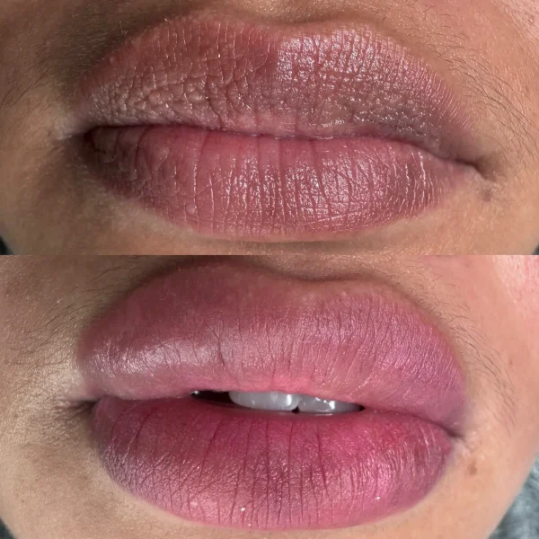 lip pigmentation tattoo melbourne